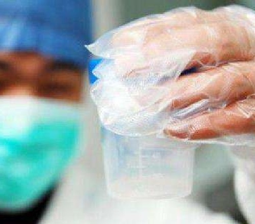 男方在做試管嬰兒時需要做哪些檢查？