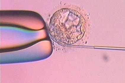 促排取卵會(huì)不會(huì)痛？對(duì)身體有沒有影響？