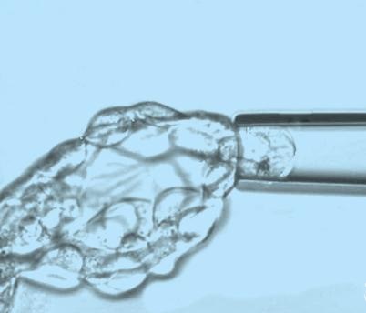 備孕試管嬰兒，需要準(zhǔn)備哪些？