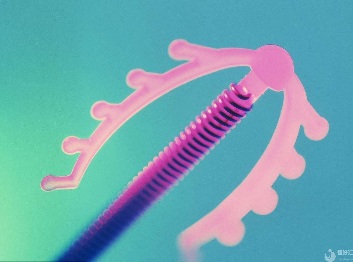 治療子宮內(nèi)膜異位癥，曼月樂環(huán)管用嗎？