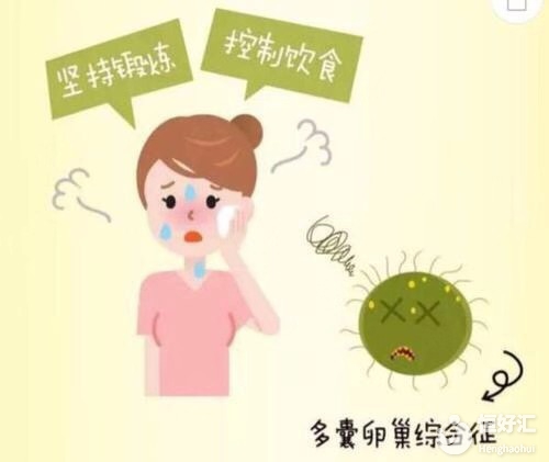 多囊卵巢綜合征，應該如何治療？