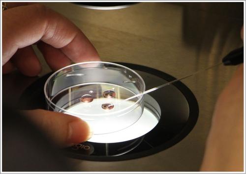 胚胎移植后有失眠現象？教你幾個解決方法