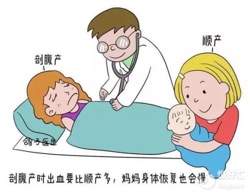 試管嬰兒到底該順產還是剖腹產？