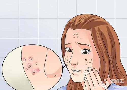 懷孕期間還能繼續(xù)用護(hù)膚品嗎？