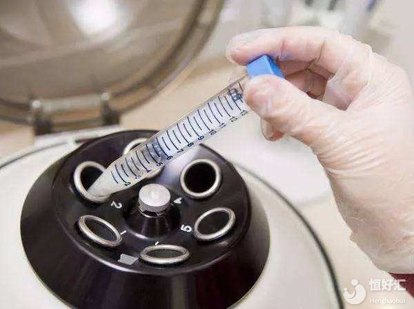 疑惑解答：什么是洗精術？洗精術的作用是什么？