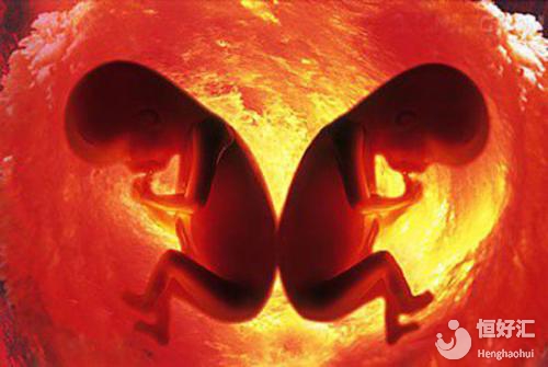 夫妻雙方做好這幾點，懷雙胞胎再也不是夢！