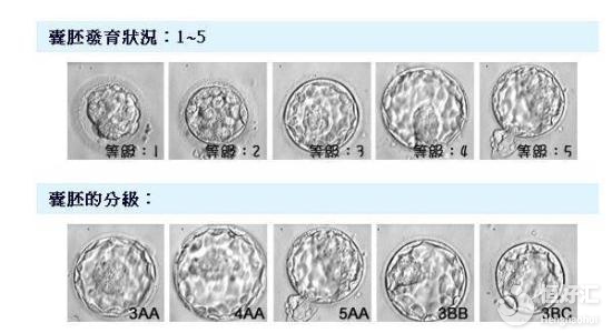 囊胚移植幾天著床？醫生：到了這一天請警惕！