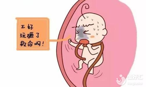 臍帶繞頸怎么辦？做好這4點(diǎn)助你巧妙緩解