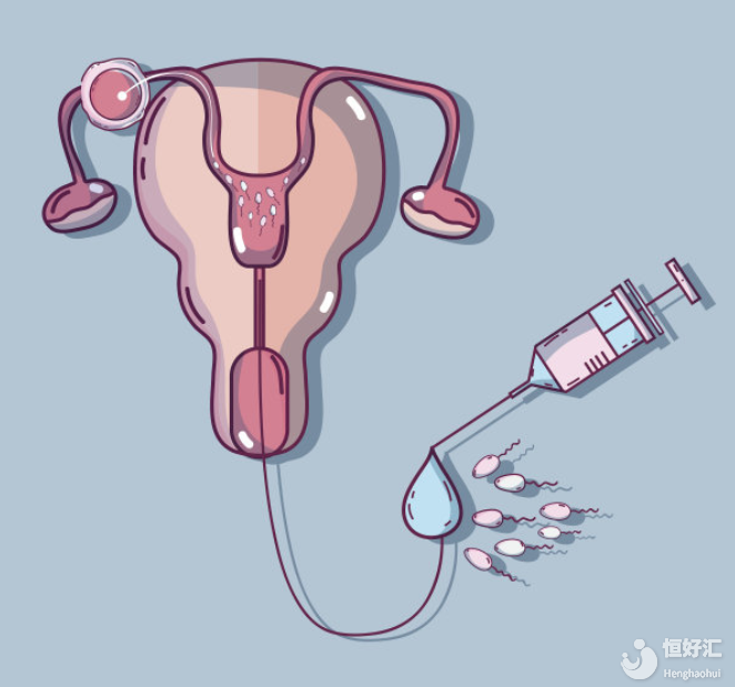 卵巢早衰不等人，做試管要趁早！