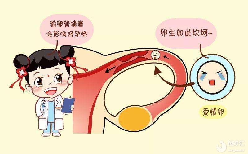 輸卵管阻塞了，我還能懷孕嗎？