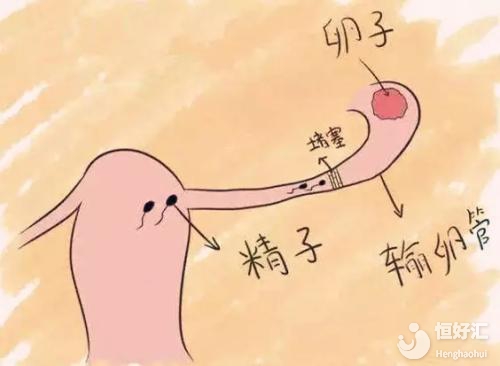 沒有輸卵管還能做試管嬰兒嗎？這一點很關鍵