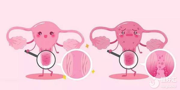 注意了！陰道出血或許和這2點有關(guān)，請警惕