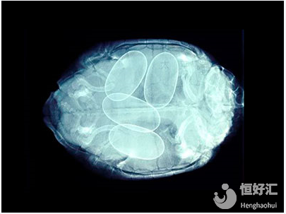 關(guān)于試管嬰兒冷凍卵子那些事兒，說出來很驚訝！