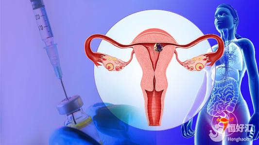 子宮切除后要注意什么？這些飲食準則請收藏