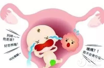 子宮肌瘤和懷孕能否共存？看完這個秒懂！